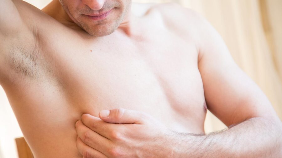 Male Breast Cancer Often Diagnosed at Advanced Stages